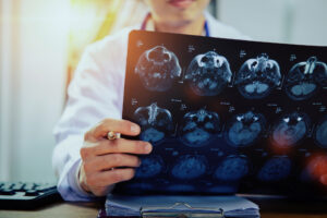 neurologie